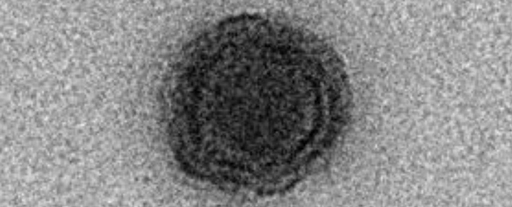 Kép: Boratto et al., 2020, bioRxiv