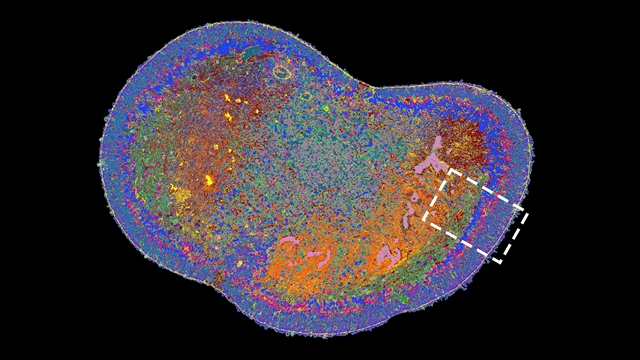 © Wahle et al. / Nature Biotechnology 2023